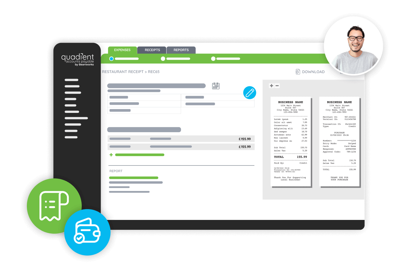 ap expense management uk